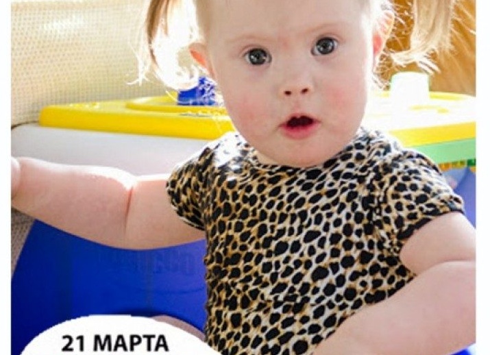 Синдром Дауна: правда и мифы